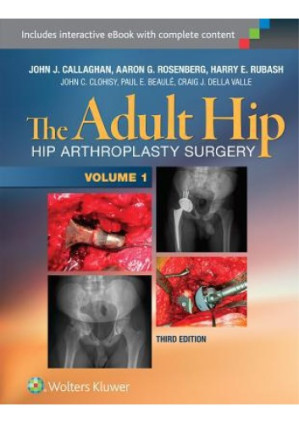the adult hip callaghan 2 volume set