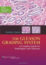 the gleason grading system a complete guide for pathologist and clinicians