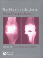 the haemophilic joints new perspectives