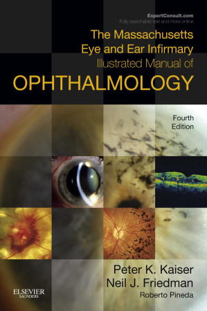 the massachusetts eye and ear infirmary illustrated manual of ophthalmology 4th edition april 2014 release