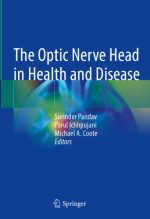 the optic nerve evaluation in glaucoma an interactive workbook