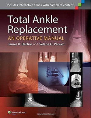 total ankle replacement an operative manual