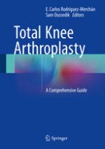 total knee arthroplasty a comprehensive guide