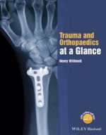 trauma and orthopaedics at a glance june 2015 release
