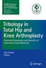 tribology in total hip and knee arthroplasty potential drawbacks and benefits of commonly used materials 2014 release