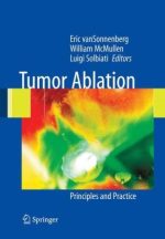 tumor ablation principles and practice