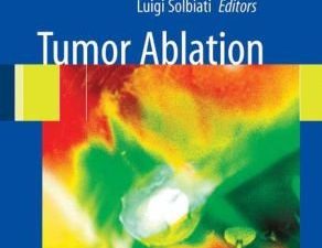 tumor ablation principles and practice
