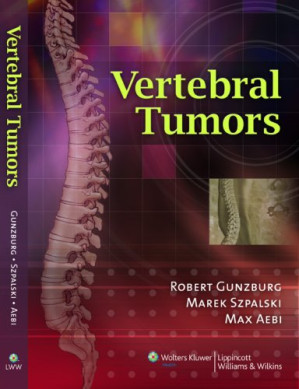 vertebral tumors