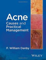 acne causes and practical management 2015 release