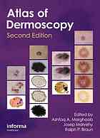 an atlas of dermoscopy 2nd edition
