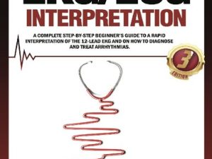 arrhythmias