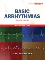 basic arrhythmias 7th edition