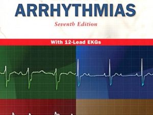 basic arrhythmias 7th edition