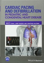 cardiac pacing and defibrillation in pediatric and congenital heart disease