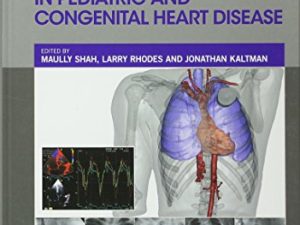 cardiac pacing and defibrillation in pediatric and congenital heart disease 1st edition