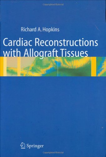 cardiac surgery in the adult