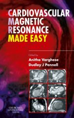 cardiovascular magnetic resonance made easy