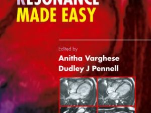 cardiovascular magnetic resonance made easy