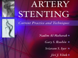 carotid artery stenting current practice and techniques