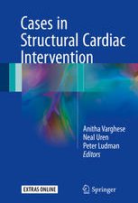 cases in structural cardiac intervention