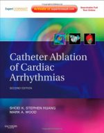 catheter ablation of cardiac arrhythmias