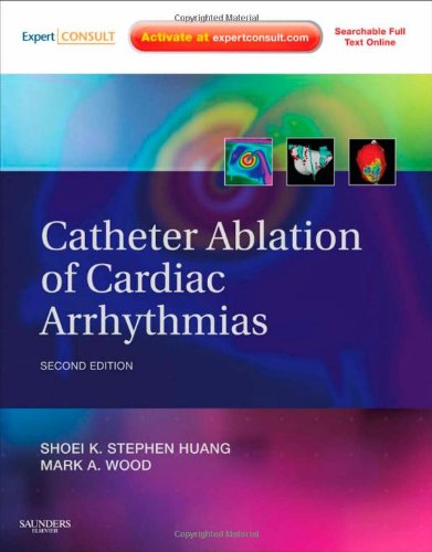 catheter ablation of cardiac arrhythmias