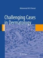 challenging cases in dermatology 2013