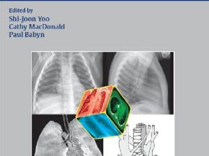 chest radiographic interpretation in pediatric cardiac patients 1st edition