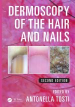 dermoscopy of the hair and nails 2nd edition june 2015 release
