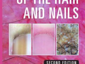 dermoscopy of the hair and nails 2nd edition june 2015 release