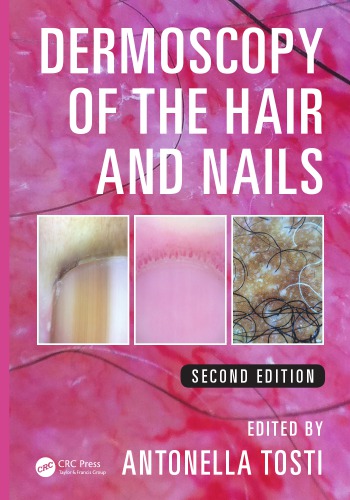 dermoscopy of the hair and nails 2nd edition june 2015 release