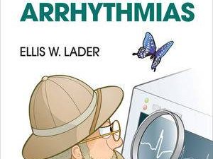 field guide to the arrhythmias
