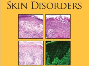 inflammatory skin disorders demos surgical pathology guides