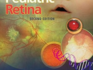 pediatric retina 2nd edition