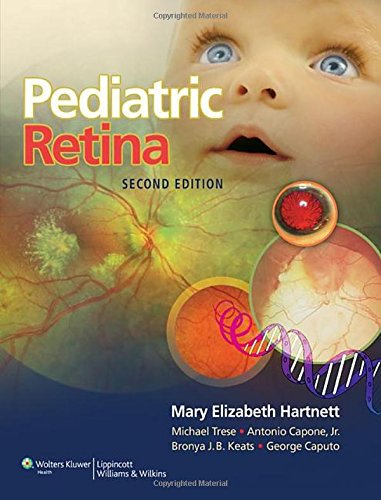 pediatric retina 2nd edition