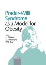 prader willi syndrome as a model for obesity