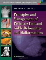 principles and management of pediatric foot and ankle deformities and malformations