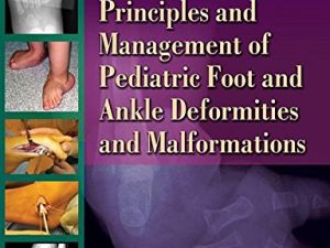 principles and management of pediatric foot and ankle deformities and malformations