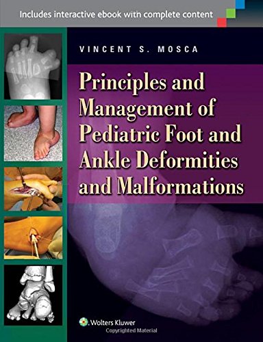 principles and management of pediatric foot and ankle deformities and malformations