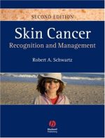 skin cancer recognition and management 2nd edition