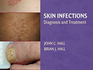 skin infections diagnosis and treatment
